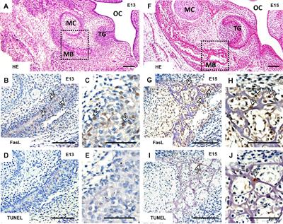 FasL Modulates Expression of Mmp2 in Osteoblasts